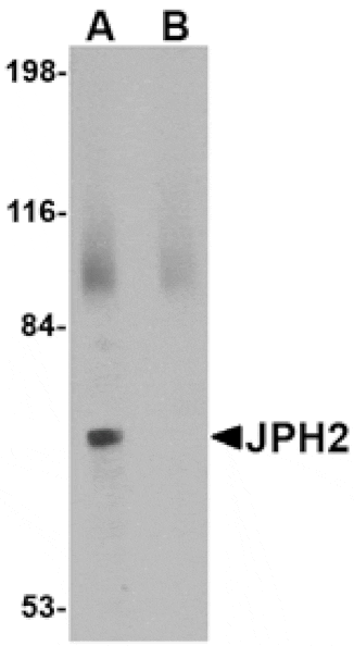 Western blot - JPH2 Antibody from Signalway Antibody (24794) - Antibodies.com