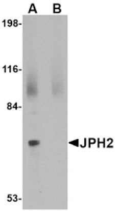 Western blot - JPH2 Antibody from Signalway Antibody (24794) - Antibodies.com