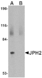 Western blot - JPH2 Antibody from Signalway Antibody (24794) - Antibodies.com