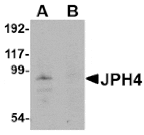 Western blot - JPH4 Antibody from Signalway Antibody (24800) - Antibodies.com