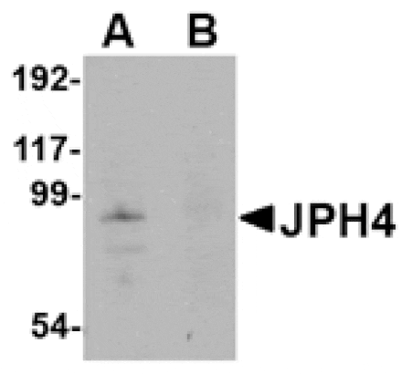 Western blot - JPH4 Antibody from Signalway Antibody (24800) - Antibodies.com