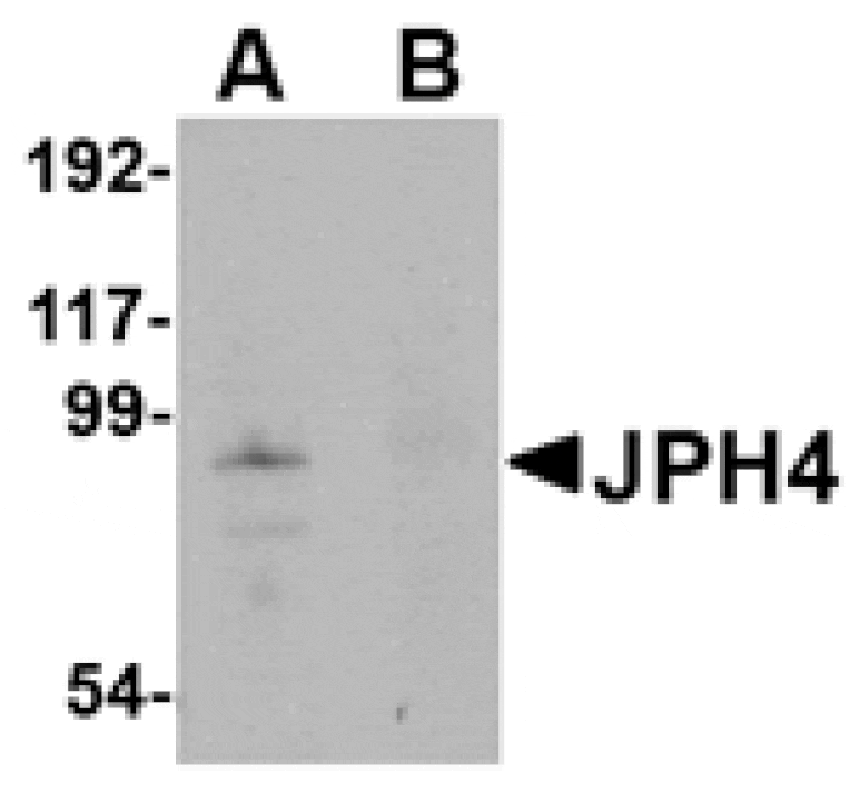 Western blot - JPH4 Antibody from Signalway Antibody (24800) - Antibodies.com