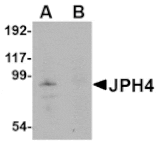 Western blot - JPH4 Antibody from Signalway Antibody (24800) - Antibodies.com