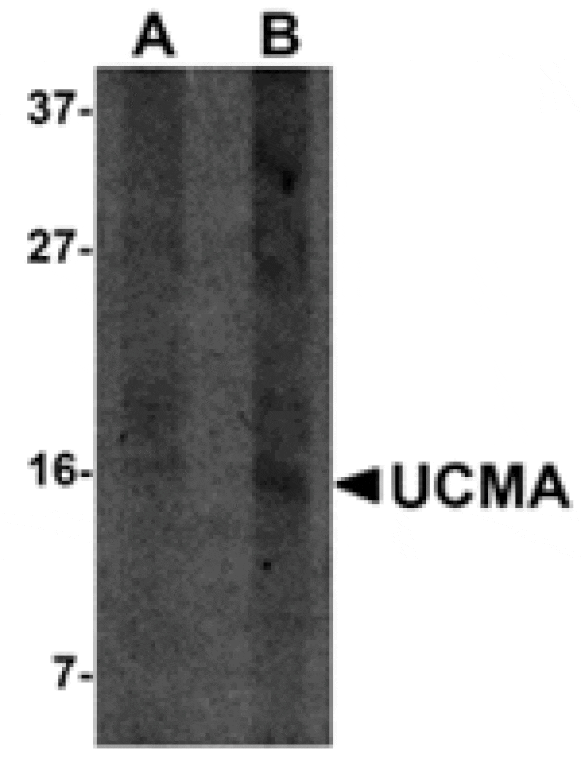 Western blot - UCMA Antibody from Signalway Antibody (24908) - Antibodies.com