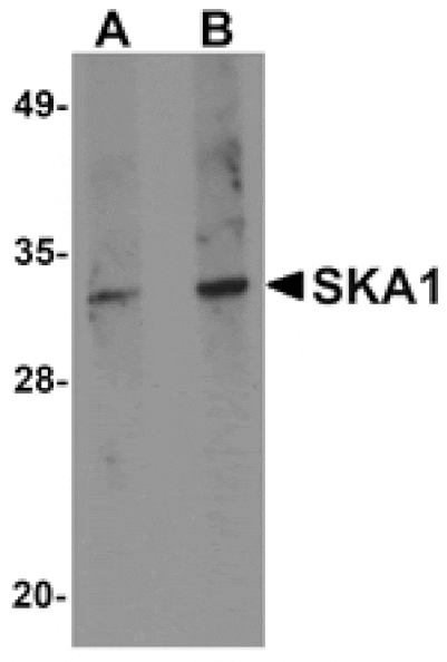 Western blot - SKA1 Antibody from Signalway Antibody (24970) - Antibodies.com