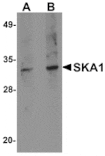 Western blot - SKA1 Antibody from Signalway Antibody (24970) - Antibodies.com