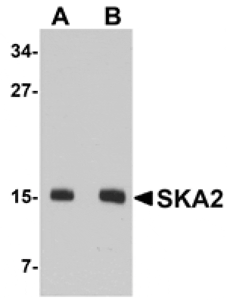 Western blot - SKA2 Antibody from Signalway Antibody (24971) - Antibodies.com