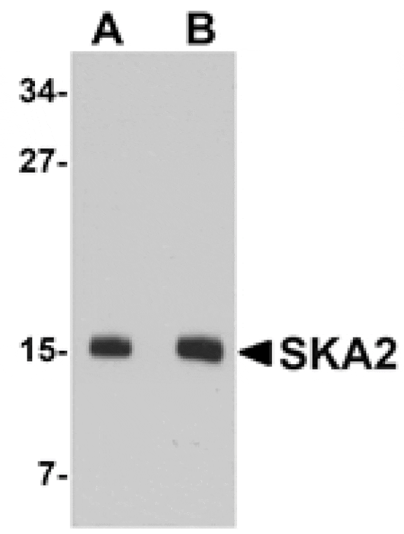 Western blot - SKA2 Antibody from Signalway Antibody (24971) - Antibodies.com