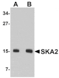 Western blot - SKA2 Antibody from Signalway Antibody (24971) - Antibodies.com