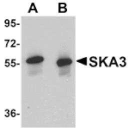 Western blot - SKA3 Antibody from Signalway Antibody (24972) - Antibodies.com