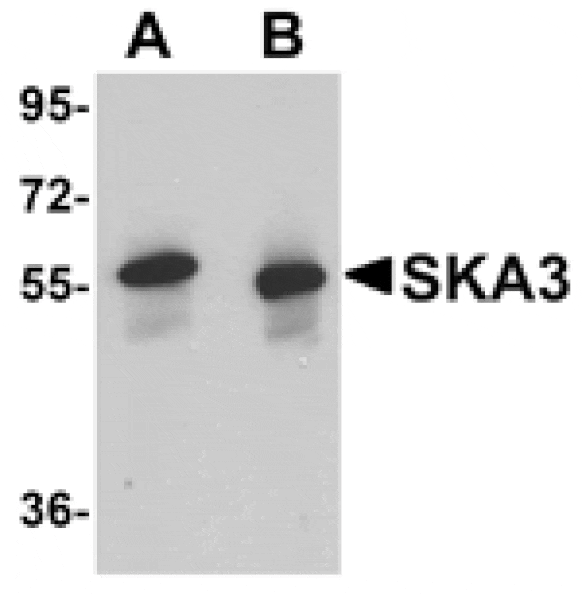 Western blot - SKA3 Antibody from Signalway Antibody (24972) - Antibodies.com