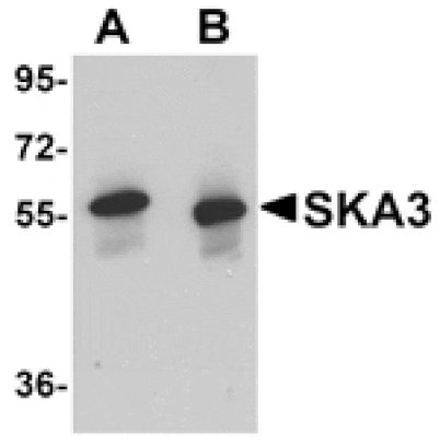 Western blot - SKA3 Antibody from Signalway Antibody (24972) - Antibodies.com