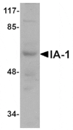 Western blot - IA-1 Antibody from Signalway Antibody (24977) - Antibodies.com