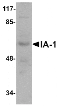 Western blot - IA-1 Antibody from Signalway Antibody (24977) - Antibodies.com