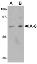 Western blot - IA-6 Antibody from Signalway Antibody (24978) - Antibodies.com