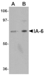 Western blot - IA-6 Antibody from Signalway Antibody (24978) - Antibodies.com