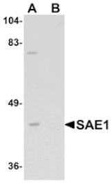 Western blot - SAE1 Antibody from Signalway Antibody (25115) - Antibodies.com