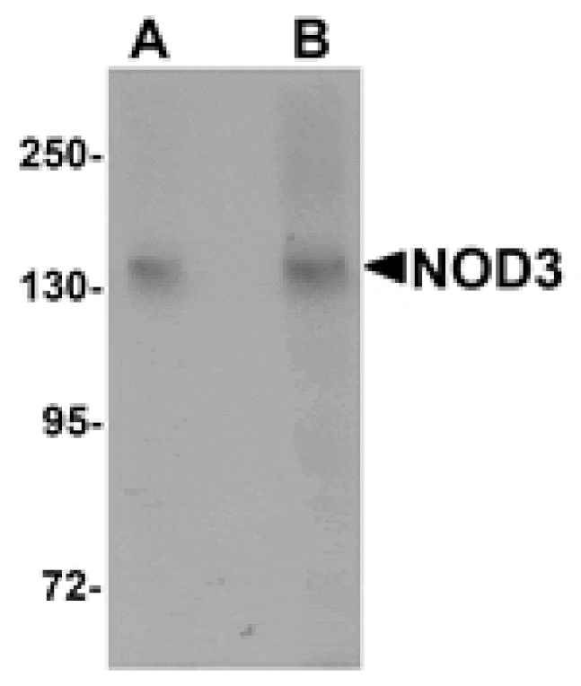 Western blot - NOD3 Antibody from Signalway Antibody (25175) - Antibodies.com