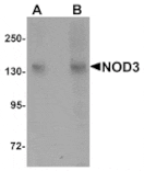 Western blot - NOD3 Antibody from Signalway Antibody (25175) - Antibodies.com
