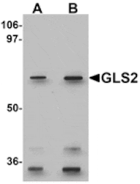 Western blot - GLS2 Antibody from Signalway Antibody (25272) - Antibodies.com