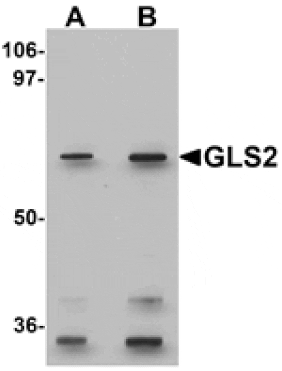 Western blot - GLS2 Antibody from Signalway Antibody (25272) - Antibodies.com