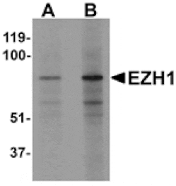 Western blot - EZH1 Antibody from Signalway Antibody (25290) - Antibodies.com