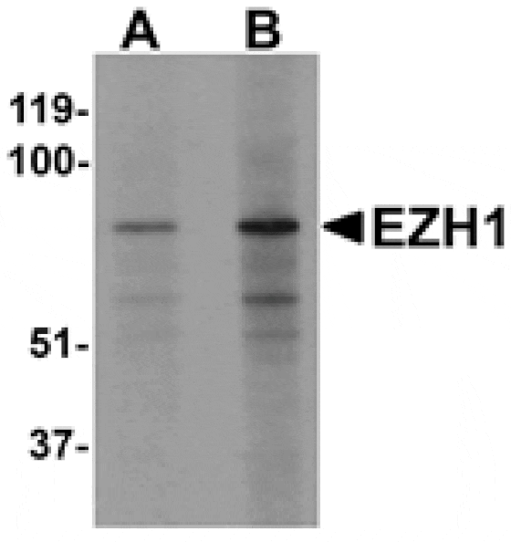Western blot - EZH1 Antibody from Signalway Antibody (25290) - Antibodies.com