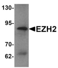 Western blot - EZH2 Antibody from Signalway Antibody (25291) - Antibodies.com