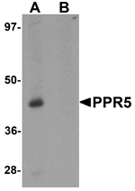 Western blot analysis of PRR5 in SK-N-SH cell lysate with PRR5 antibody at 1 µg/mL in (A) the absence and (B) the presence of blocking peptide