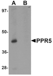 Western blot - PRR5 Antibody from Signalway Antibody (25297) - Antibodies.com