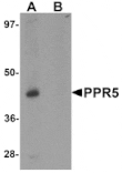 Western blot - PRR5 Antibody from Signalway Antibody (25297) - Antibodies.com