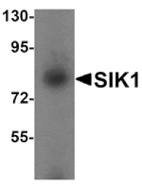 Western blot - SIK1 Antibody from Signalway Antibody (25301) - Antibodies.com