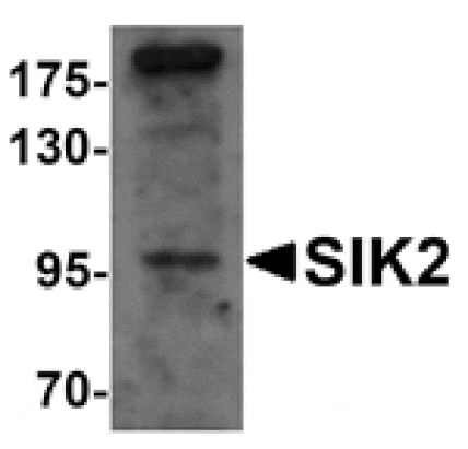 Western blot - SIK2 Antibody from Signalway Antibody (25302) - Antibodies.com