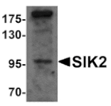 Western blot - SIK2 Antibody from Signalway Antibody (25302) - Antibodies.com
