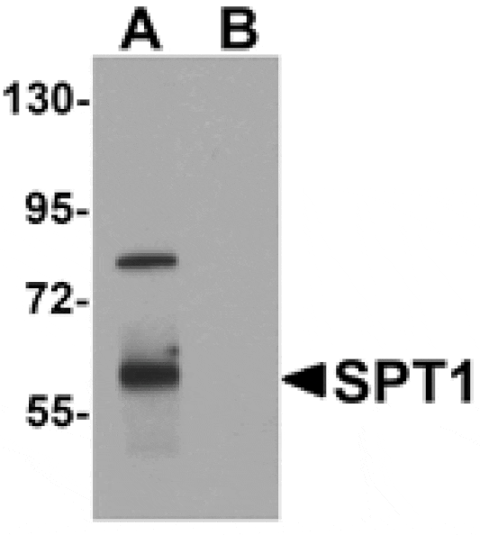 Western blot - SPT1 Antibody from Signalway Antibody (25303) - Antibodies.com
