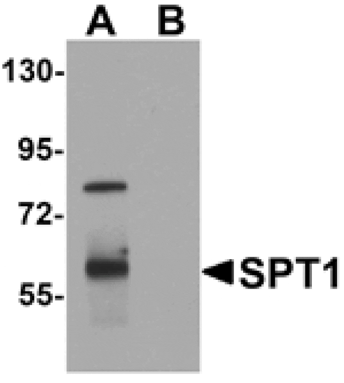 Western blot - SPT1 Antibody from Signalway Antibody (25303) - Antibodies.com
