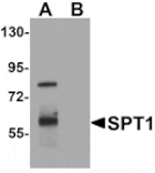 Western blot - SPT1 Antibody from Signalway Antibody (25303) - Antibodies.com