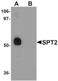 Western blot - SPT2 Antibody from Signalway Antibody (25304) - Antibodies.com