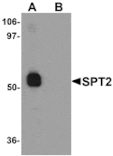 Western blot - SPT2 Antibody from Signalway Antibody (25304) - Antibodies.com