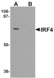 Western blot - IRF4 Antibody from Signalway Antibody (25305) - Antibodies.com