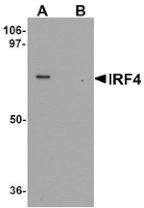 Western blot - IRF4 Antibody from Signalway Antibody (25305) - Antibodies.com