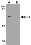 Western blot - IRF4 Antibody from Signalway Antibody (25305) - Antibodies.com