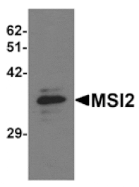 Western blot - MSI2 Antibody from Signalway Antibody (25306) - Antibodies.com