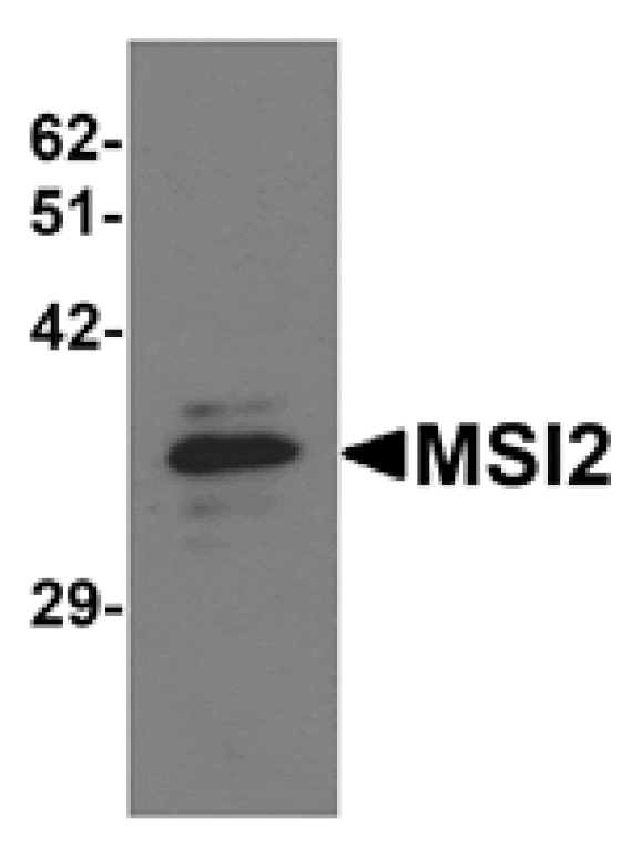 Western blot - MSI2 Antibody from Signalway Antibody (25306) - Antibodies.com