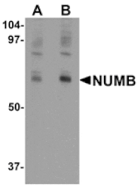 Western blot - NUMB Antibody from Signalway Antibody (25307) - Antibodies.com
