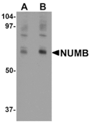 Western blot - NUMB Antibody from Signalway Antibody (25307) - Antibodies.com