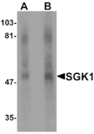 Western blot - SGK1 Antibody from Signalway Antibody (25309) - Antibodies.com