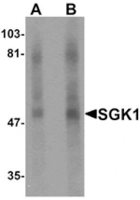 Western blot - SGK1 Antibody from Signalway Antibody (25309) - Antibodies.com
