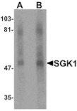 Western blot - SGK1 Antibody from Signalway Antibody (25309) - Antibodies.com