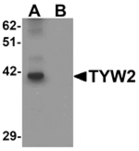Western blot - TYW2 Antibody from Signalway Antibody (25315) - Antibodies.com
